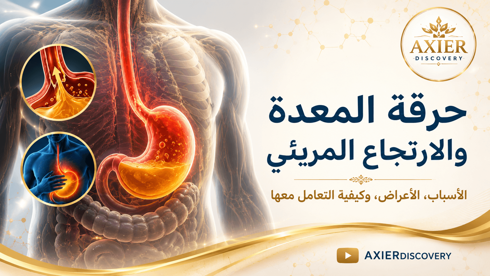 حرقة المعدة والارتجاع المريئي