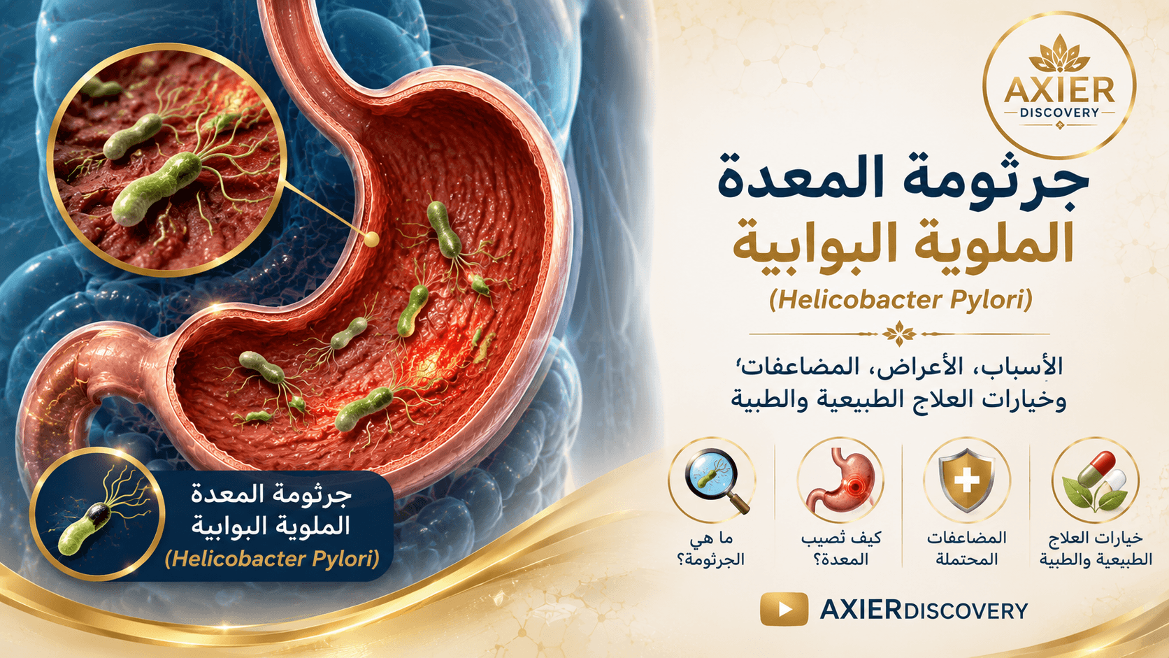 صورة توضيحية لجرثومة المعدة الملوية البوابية (Helicobacter pylori)، تُظهر وجود البكتيريا على بطانة المعدة وتأثيرها عليها – AXIER Discovery.