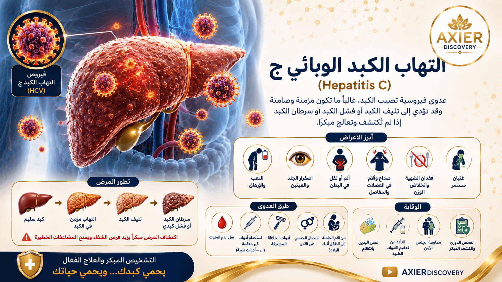 صورة توضيحية لالتهاب الكبد الوبائي ج (Hepatitis C)، تُظهر الكبد وتأثير فيروس HCV عليه، مع أبرز الأعراض وطرق انتقال العدوى والوقاية وتطور المرض – AXIER Discovery.