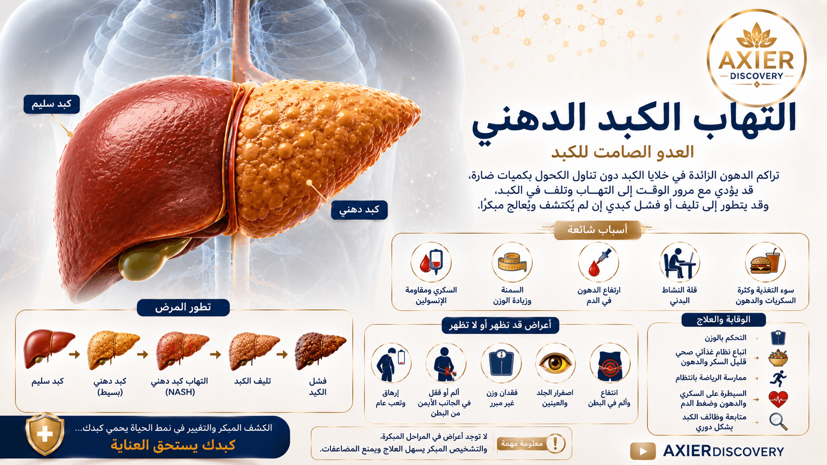 صورة توضيحية للكبد الدهني، تُظهر الفرق بين الكبد السليم والكبد المتراكم فيه الدهون، مع مراحل تطور الحالة وأبرز الأسباب والأعراض وطرق الوقاية والعناية بالكبد – AXIER Discovery.