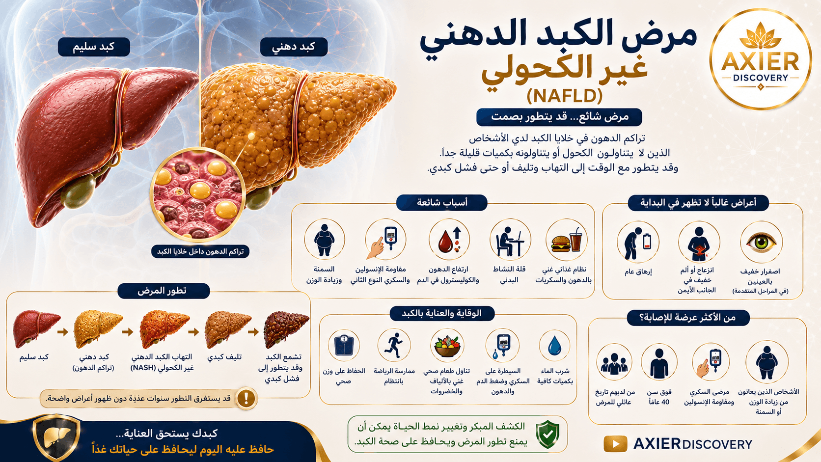 صورة توضيحية لمرض الكبد الدهني غير الكحولي (NAFLD)، تُظهر الفرق بين الكبد السليم والكبد الدهني، وتراكم الدهون داخل خلايا الكبد، مع مراحل تطور المرض وأبرز عوامل الخطورة وطرق الوقاية – AXIER Discovery.