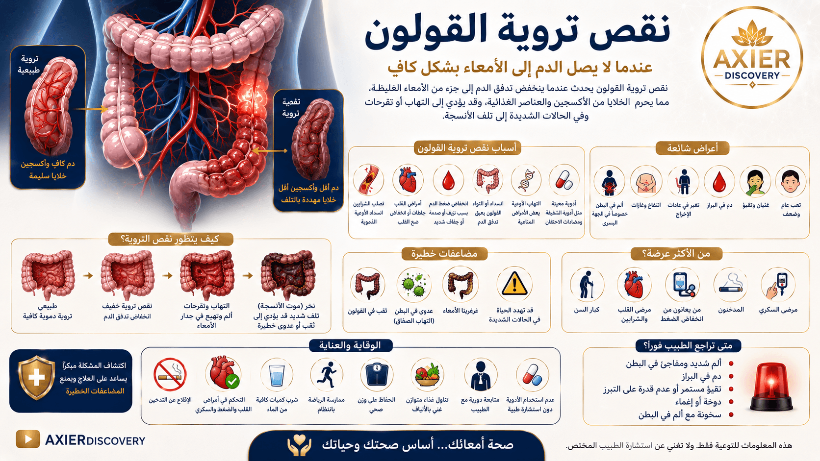 صورة توضيحية لنقص تروية القولون، تُظهر انخفاض تدفق الدم والأكسجين إلى أجزاء من القولون وتأثيره على الأنسجة، مع أبرز الأسباب والأعراض والمضاعفات وعلامات الخطر – AXIER Discovery.