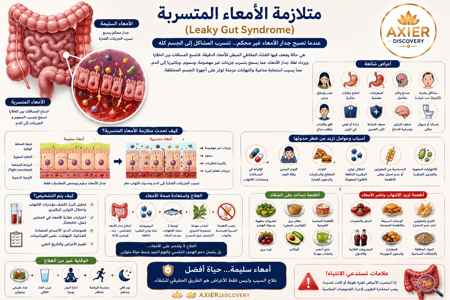 صورة توضيحية لمتلازمة الأمعاء المتسربة (Leaky Gut Syndrome)، تُظهر الفرق بين بطانة الأمعاء السليمة وزيادة نفاذية الحاجز المعوي، مع العوامل المرتبطة بها والأعراض وطرق دعم صحة الأمعاء – AXIER Discovery.
