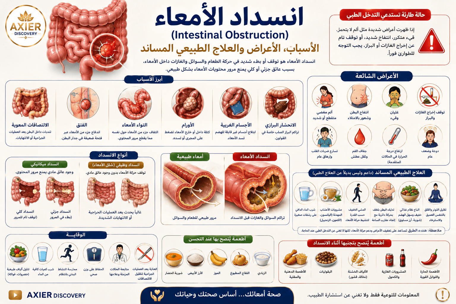 صورة توضيحية لانسداد الأمعاء (Intestinal Obstruction)، تُظهر توقف أو صعوبة مرور محتويات الأمعاء، مع أبرز الأسباب والأعراض وأنواع الانسداد، وطرق الوقاية والعلاج المساند وعلامات الخطر التي تستدعي التدخل