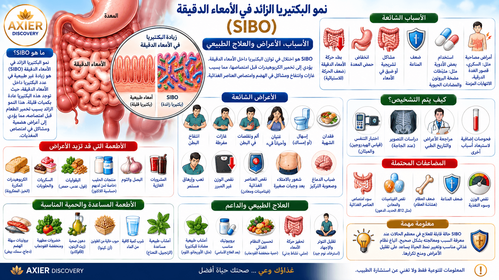صورة توضيحية لنمو البكتيريا الزائد في الأمعاء الدقيقة (SIBO)، تُظهر زيادة البكتيريا داخل الأمعاء الدقيقة وتأثيرها على الهضم وامتصاص العناصر الغذائية، مع أبرز الأسباب والأعراض وطرق التشخيص والعلاج الدا