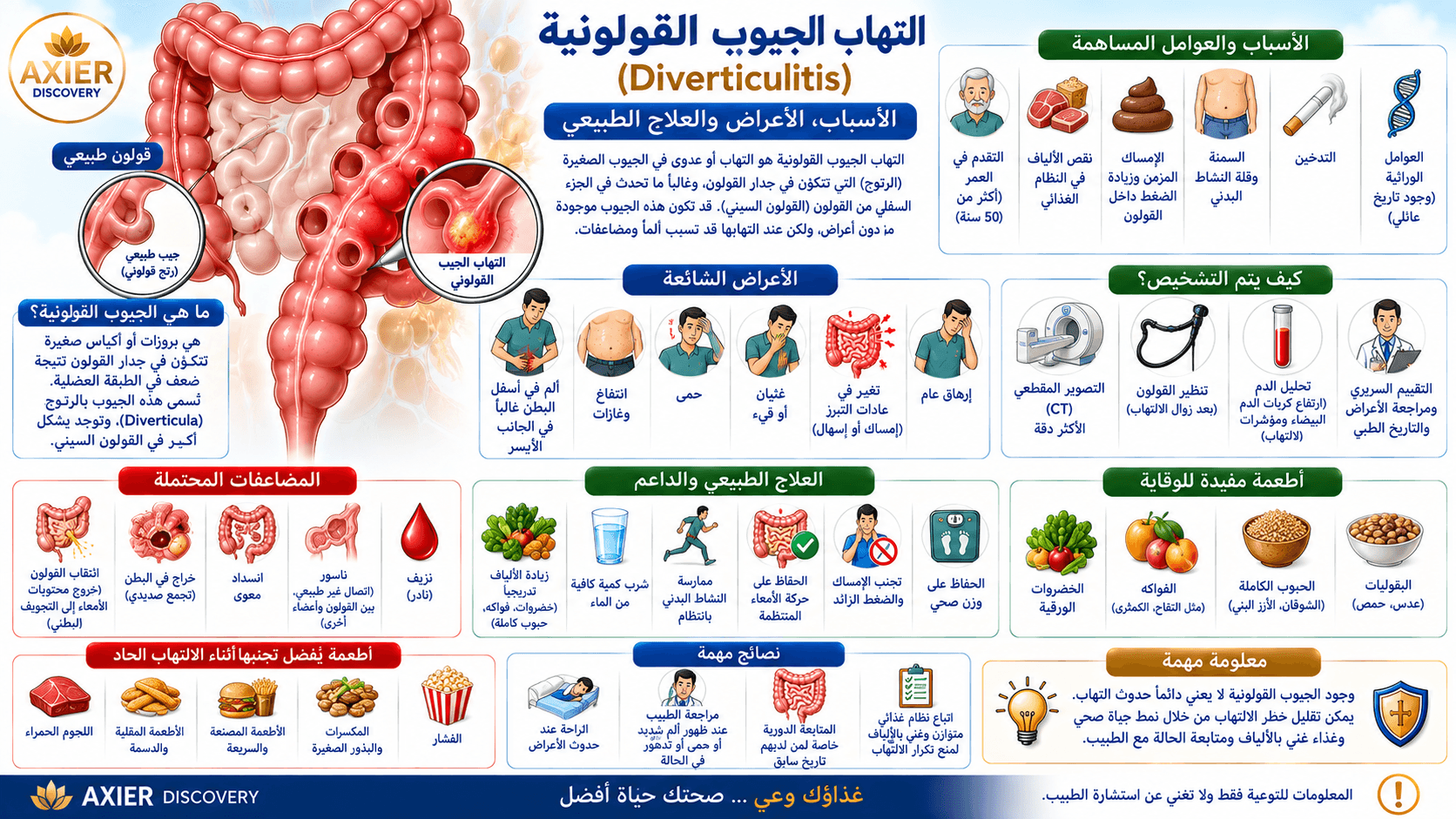 صورة توضيحية لالتهاب الجيوب القولونية (Diverticulitis)، تُظهر الجيوب المتكوّنة في جدار القولون وحالة التهابها، مع أبرز الأسباب وعوامل الخطورة والأعراض وطرق التشخيص والمضاعفات والعلاج الداعم والوقاية –