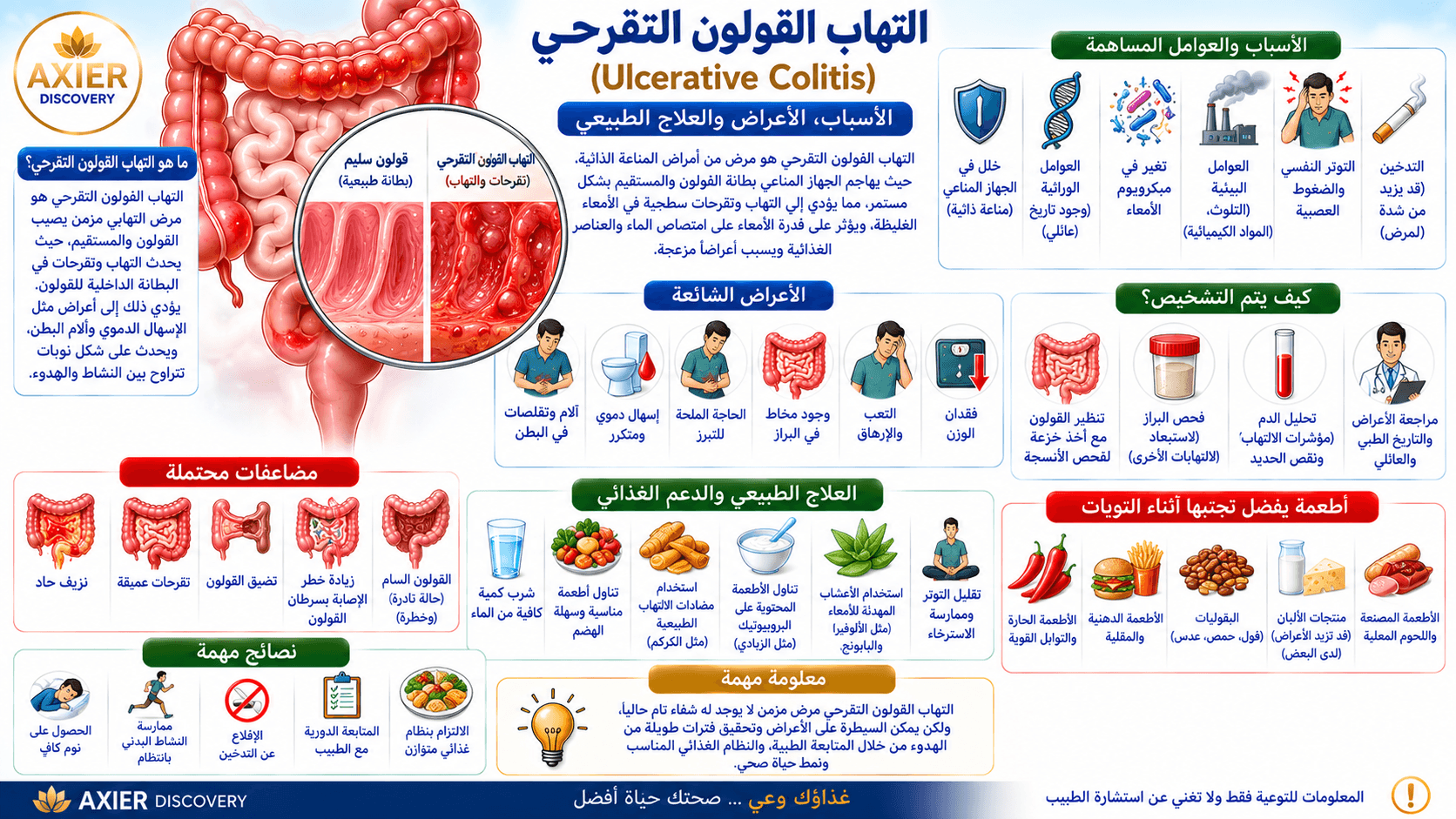 صورة توضيحية لالتهاب القولون التقرحي (Ulcerative Colitis)، تُظهر التهاب وتقرّحات بطانة القولون مقارنةً بالقولون السليم، مع أبرز الأسباب والعوامل المساهمة والأعراض وطرق التشخيص والمضاعفات والعلاج الداع