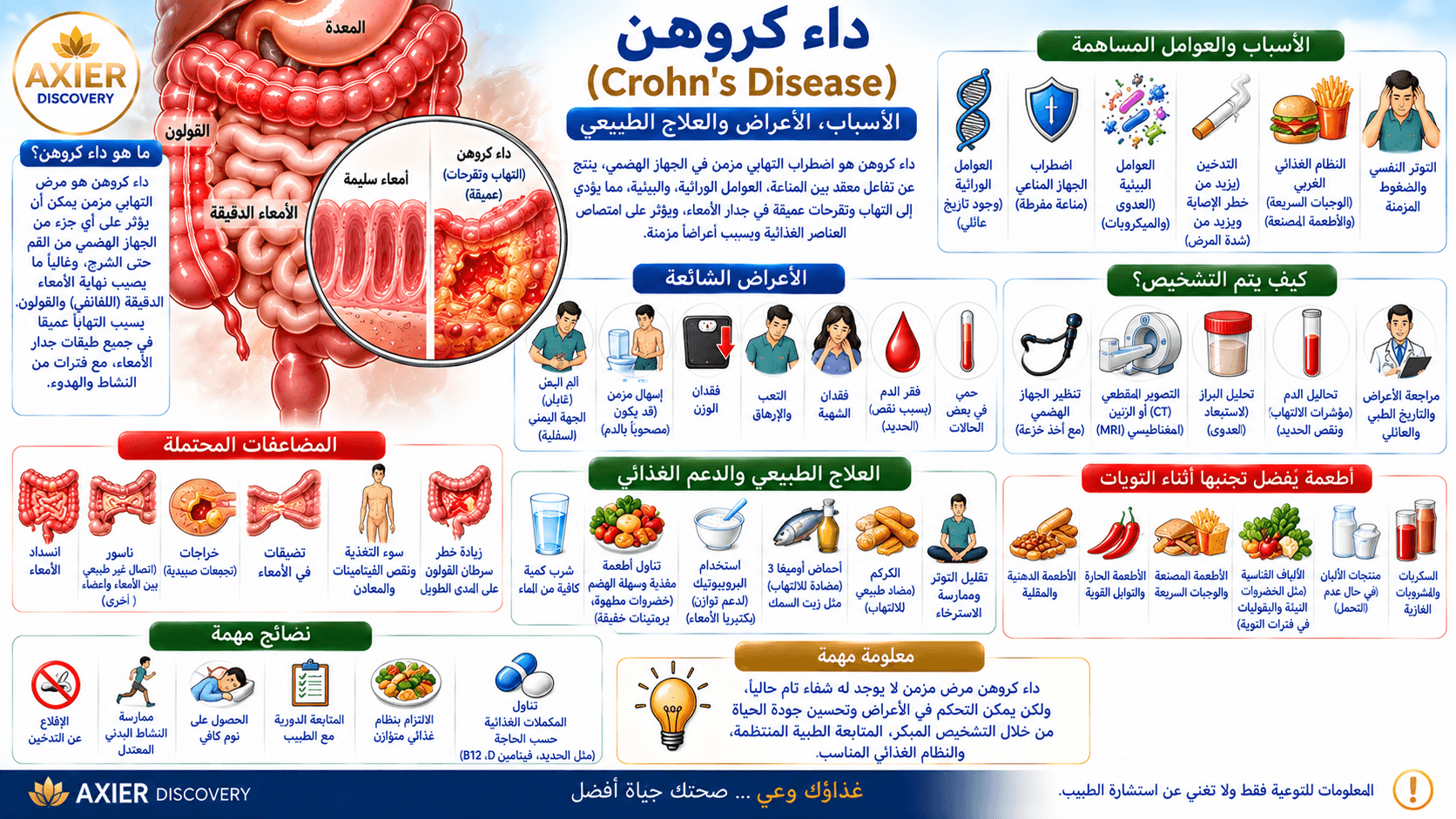 صورة توضيحية لداء كرون (Crohn’s Disease)، تُظهر الالتهاب العميق الذي قد يصيب أجزاء مختلفة من الجهاز الهضمي، مع أبرز الأسباب والعوامل المساهمة والأعراض وطرق التشخيص والمضاعفات والعلاج والدعم الغذائي –